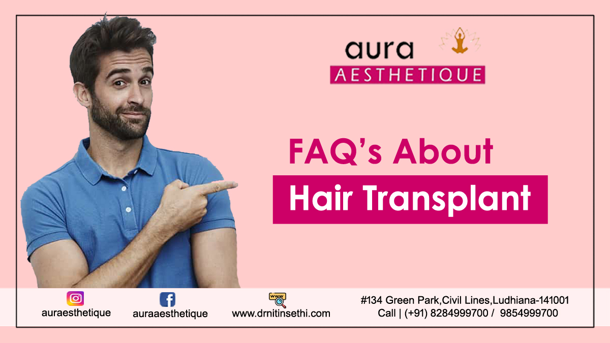 FAQ’s About Hair Transplant