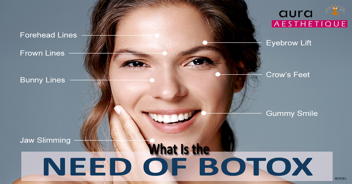 Here’s Why Do You Need Botox ?