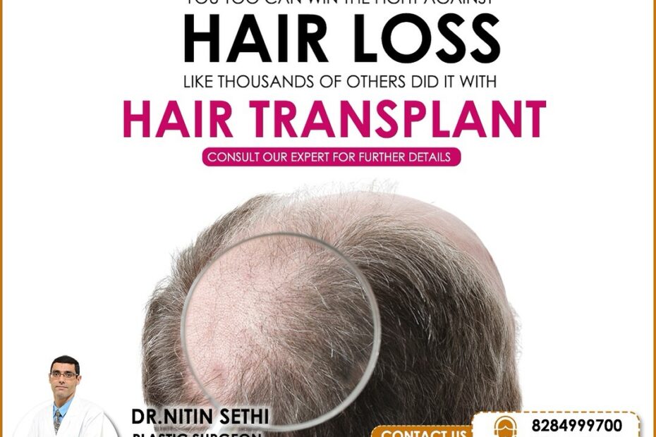 Best Hair transplant in Ludhiana