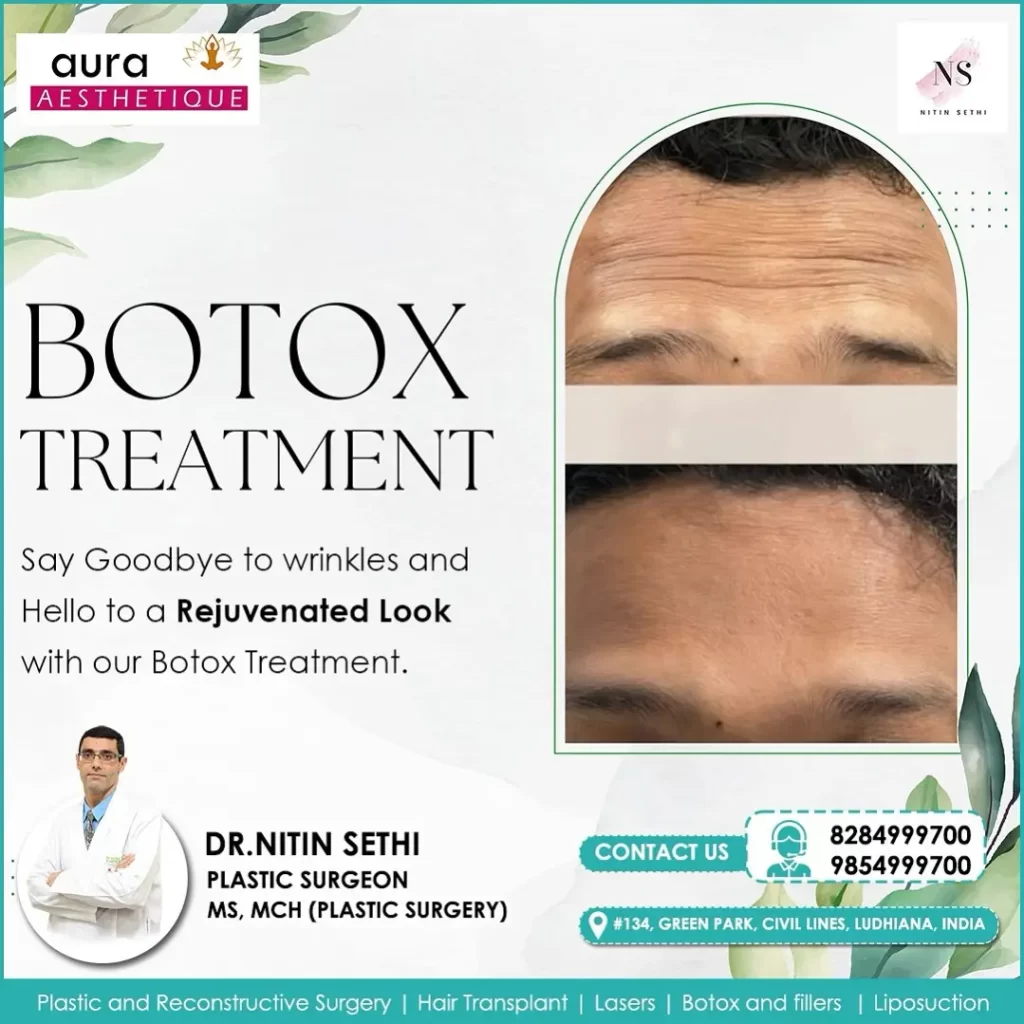 Botox Treatment in Ludhiana