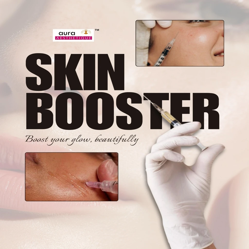 Why Skin Boosters Are the Future of Skin Rejuvenation